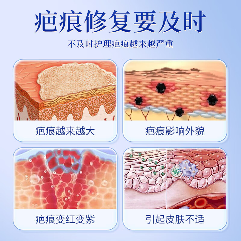 北京同仁堂内廷上用医用疤痕凝胶20g/支/盒  